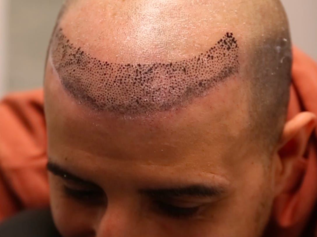 Hairline Tattoo