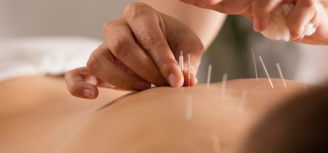 Can Acupuncture Cure Eczema? Let’s Explore This Alternative Treatment Option