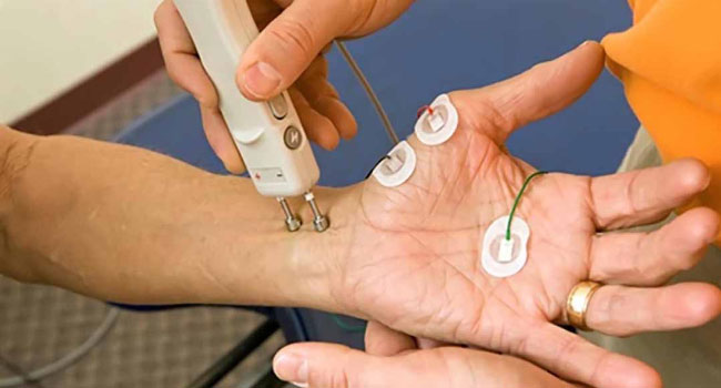 nerve conduction studies Melbourne